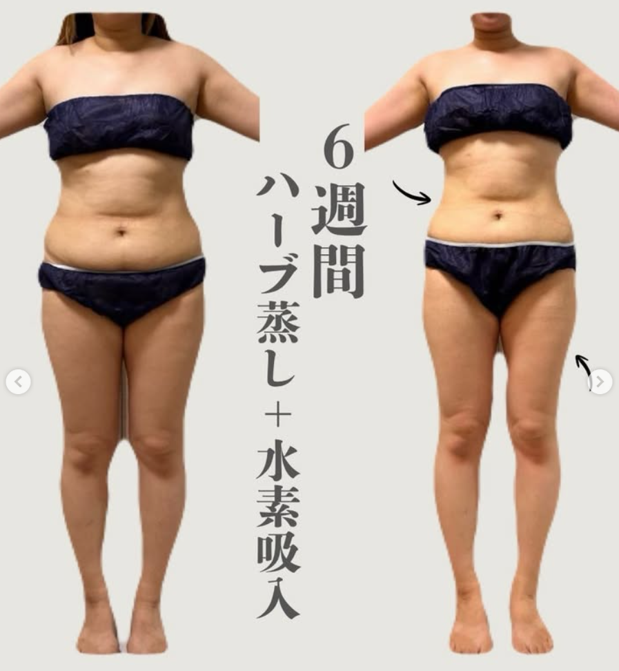 提供された正面姿の比較画像。画像内に6週間の記載あり