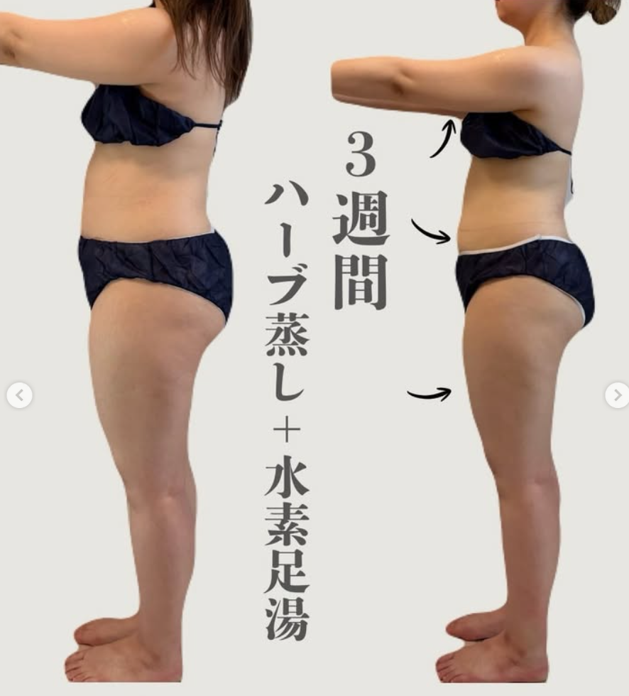 提供された横姿の比較画像。画像内に3週間の記載あり